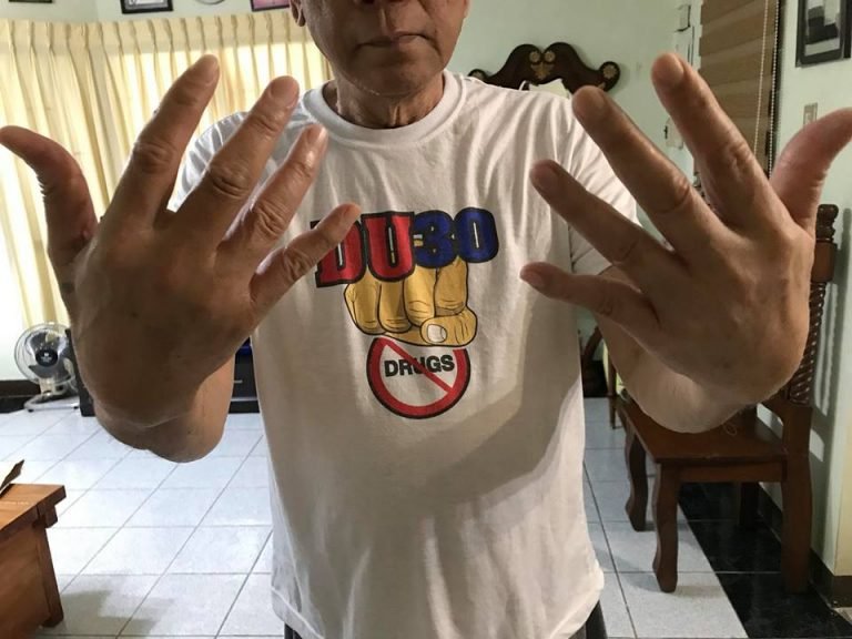 Duterte gets hand swollen