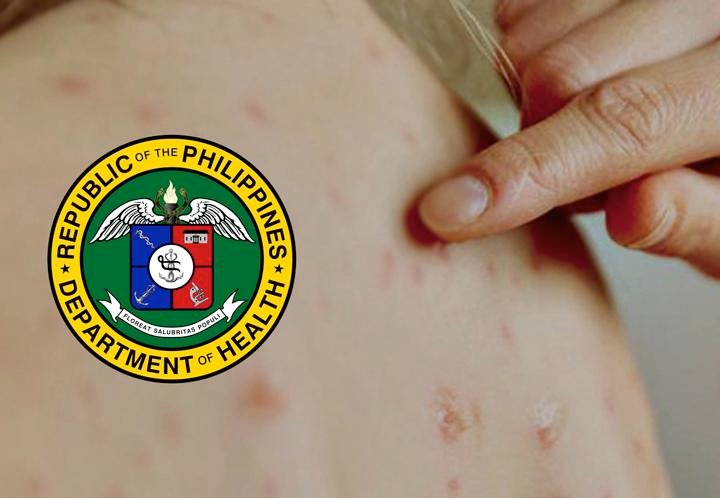 Over 945K children in BARMM jabbed against measles – DOH