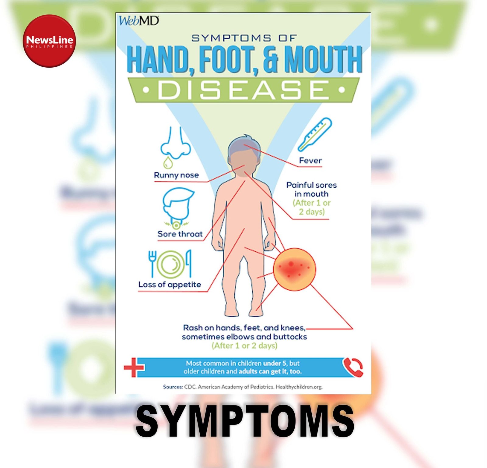 Hand Foot and Mouth Disease