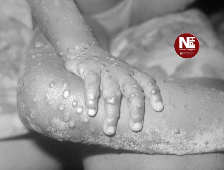 Two monkeypox cases confirmed in Region 12